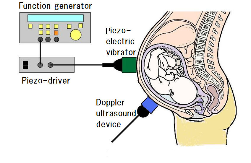 Set up for auditory evoked response in fetus