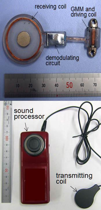 Prototype implantable bone conduction hearing aid. 