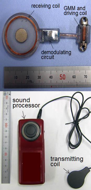 Prototype implantable bone conduction hearing aid.