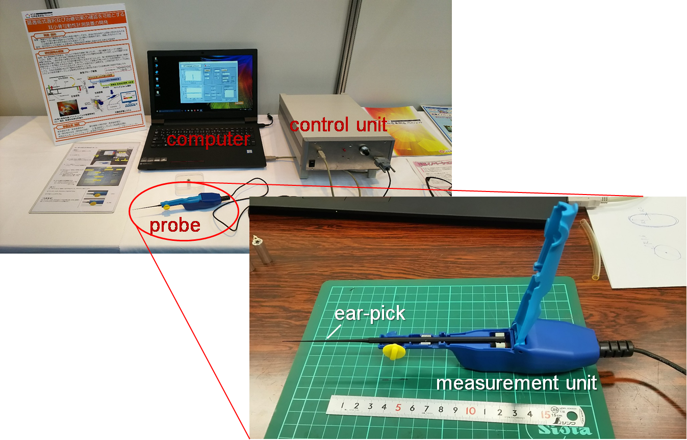 Ossicular mobility measuring device and system