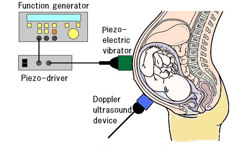 Frontiers of audiology: Quest to find effective solutions to support people with hearing loss