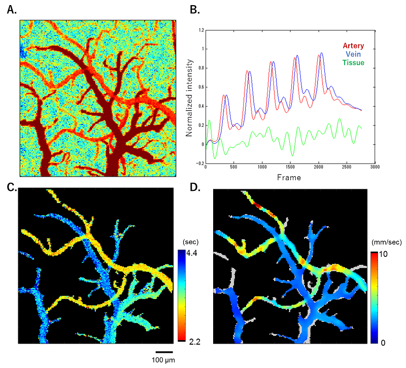 Technology for visualizing flow of blood to aid neurosurgery in the human brain